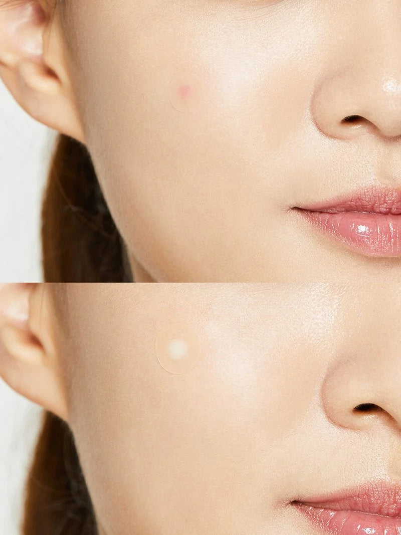 COSRX- Acne Pimple Master Parches