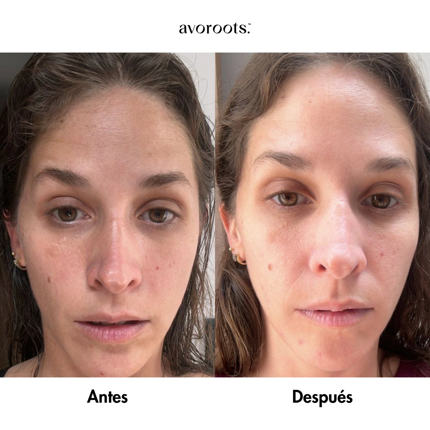 Avoroots- Hydra glow contour